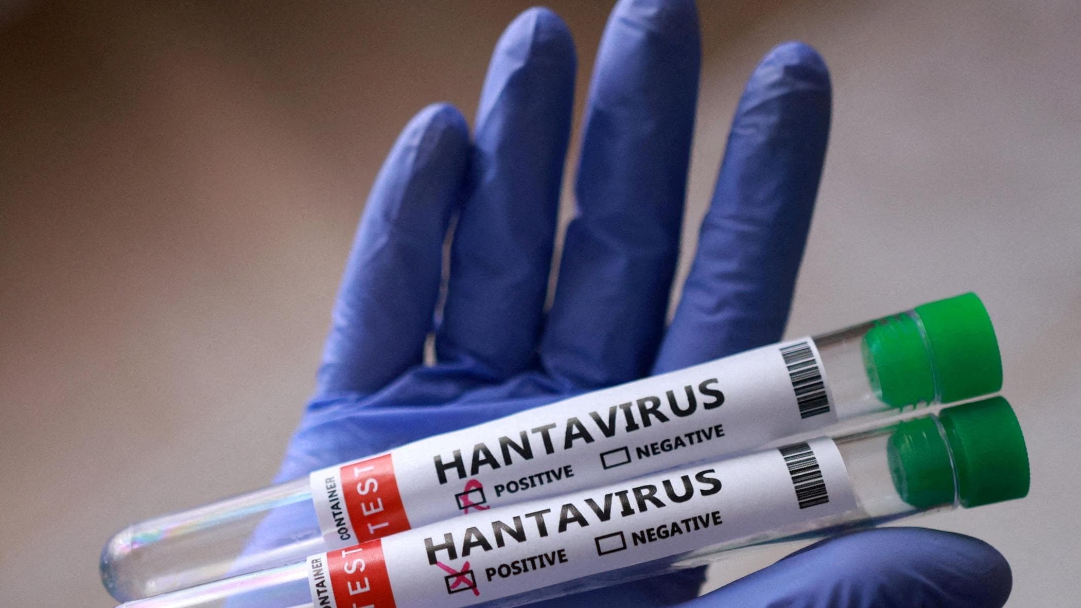 Hantavirus, individuata in Catalogna una donna entrata in contatto con virus
